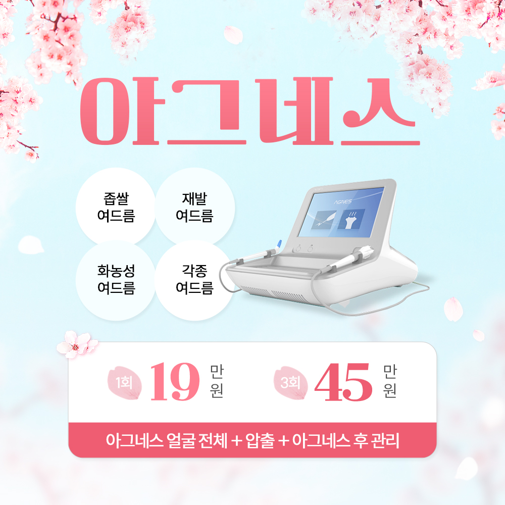 아그네스