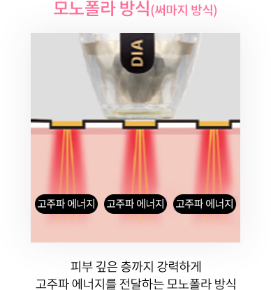 모노폴라 방식