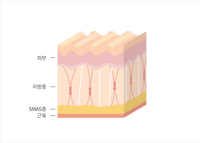 보톡스 주입 