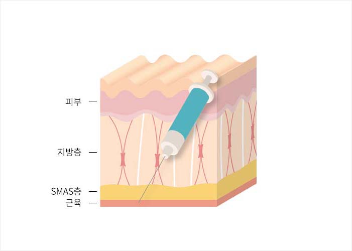 독소성분이 근육 마비 